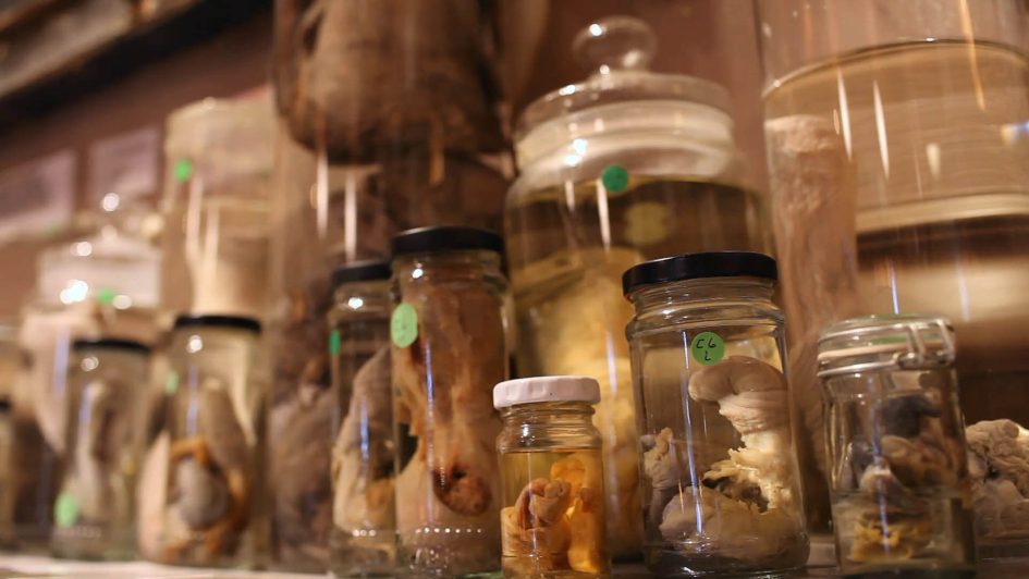 A bunch of glass jars in the museum filled with penises.